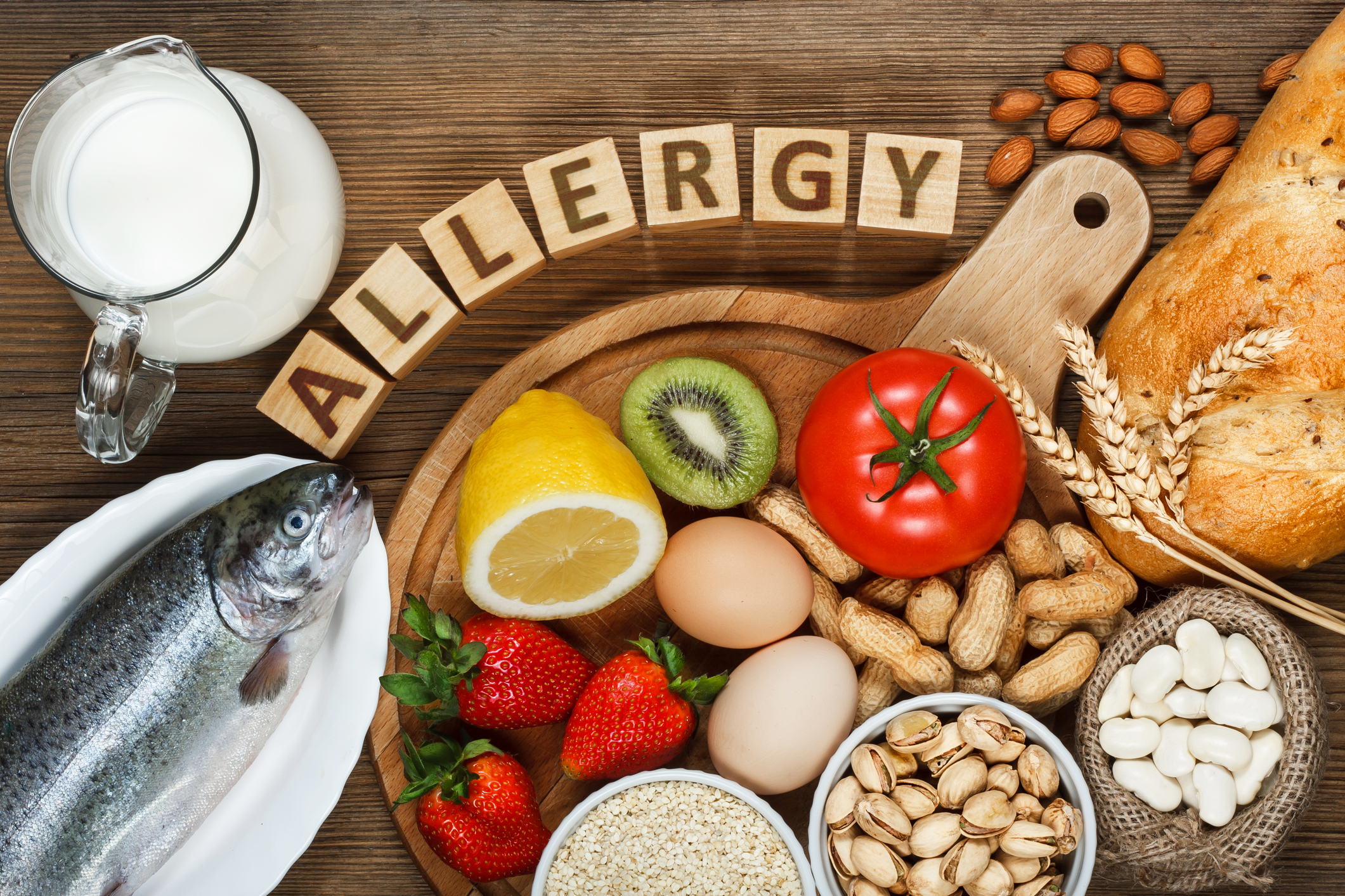 Auf einem Holztisch befinden sich ein Fisch, eine Kanne Milch, Erdbeeren, Nüsse, ein Brot, Eier, eine Kiwi, eine Tomate, Bohnen, eine Zitrone und Sesam. Über dem Brett bilden Holzbuchstaben das Wort "ALLERGY".